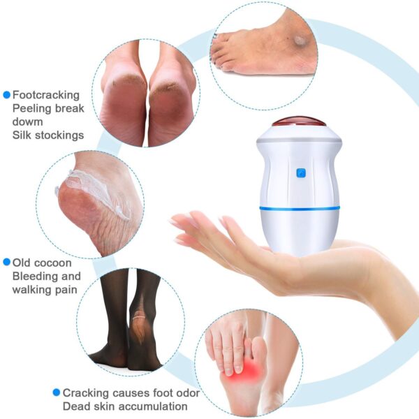 Electric Vacuum Foot Grinder